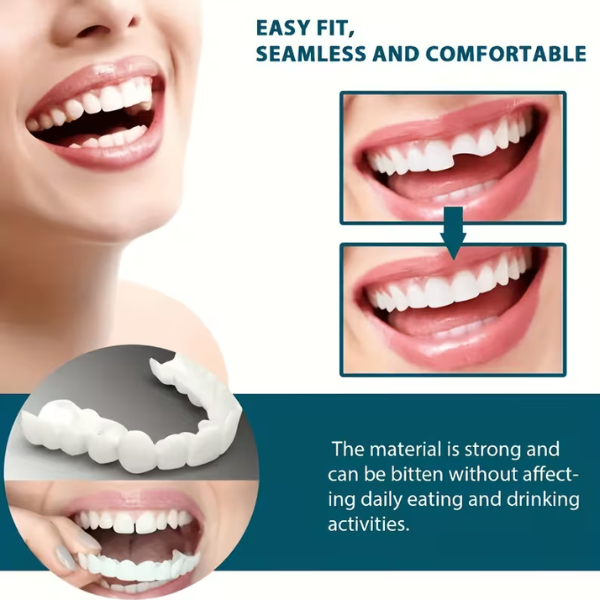 SMILEFIT PRO – SET ADAPTABIL DE DINȚI PENTRU UN ZÂMBET PERFECT