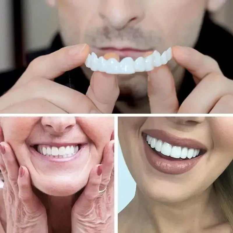 SMILEFIT PRO – SET ADAPTABIL DE DINȚI PENTRU UN ZÂMBET PERFECT