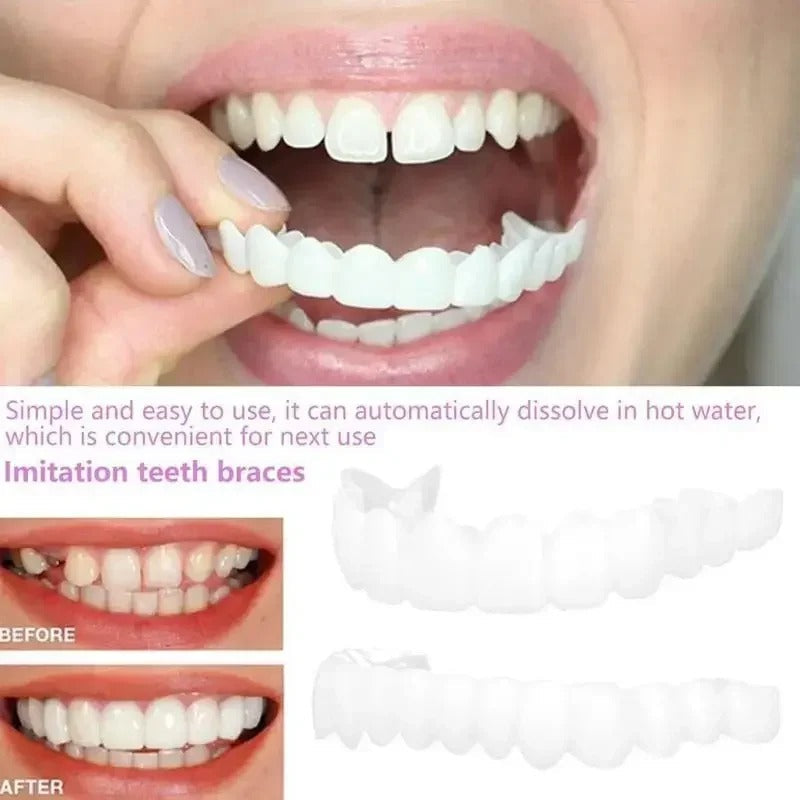 SMILEFIT PRO – SET ADAPTABIL DE DINȚI PENTRU UN ZÂMBET PERFECT