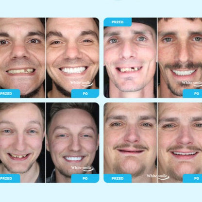 SMILEFIT PRO – SET ADAPTABIL DE DINȚI PENTRU UN ZÂMBET PERFECT